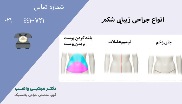 انواع جراحی زیبایی شکم