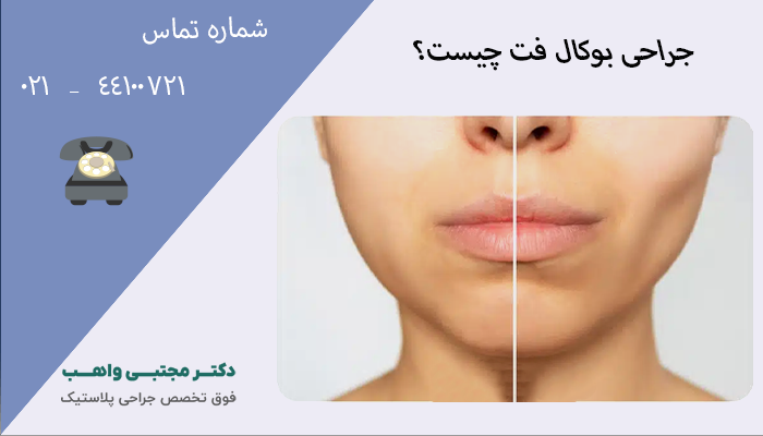 جراحی بوکال فت چیست؟