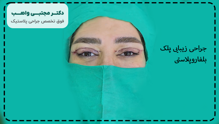 عکس جراحی پلک بالا