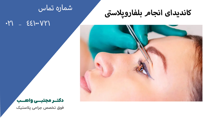 کاندیدای انجام بلفاروپلاستی