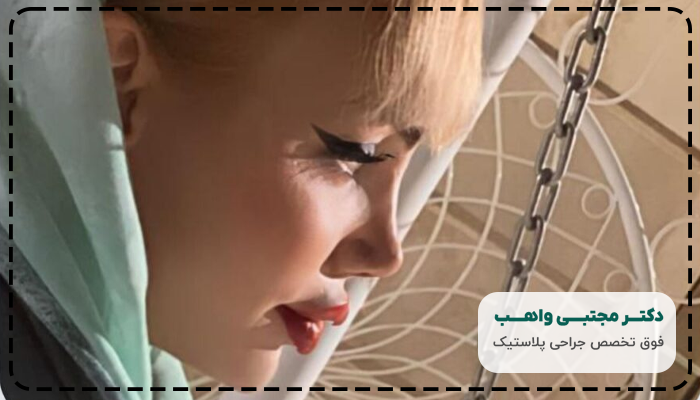 جراحی بینی فانتزی چیست؟