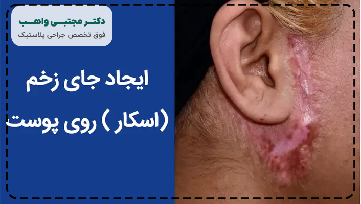 اسکار بعد از جراحی لیفت صورت