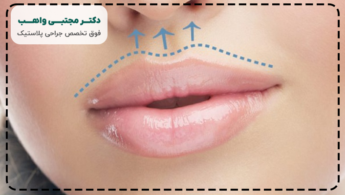 عمل سانترال لب