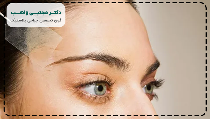 مزایای جراحی لیفت شقیقه
