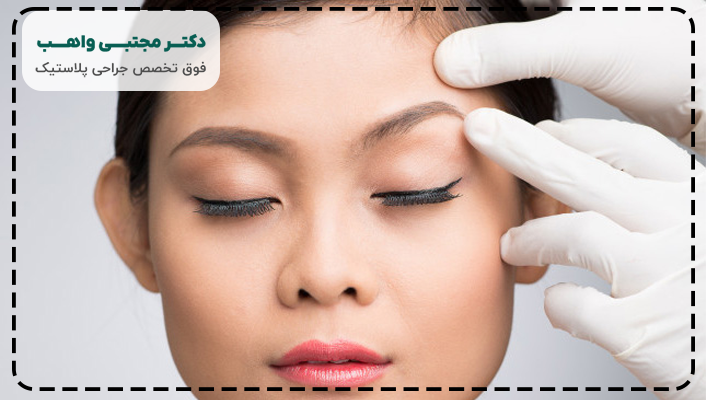 مزایای لیفت شقیقه اندوسکوپیک