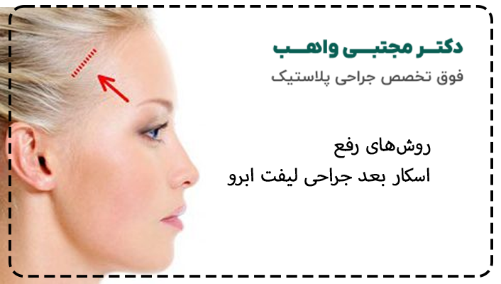 اسکار بعد از لیفت ابرو