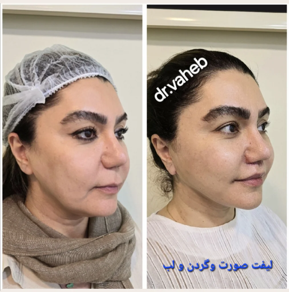 نمونه کار دکتر واهب