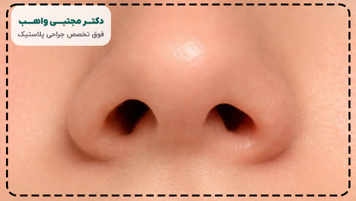 ترمیم سوراخ بینی بعد از عمل