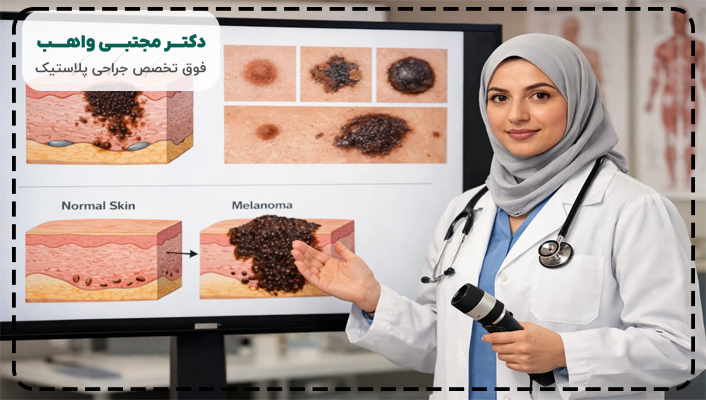 طول عمر بیماران سرطان ملانوم