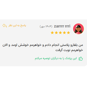 نظر مثبت جراحی پلک دکتر مجتبی واهب
