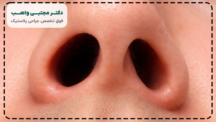 کوچک و بزرگ بودن سوراخ بینی بعد از عمل