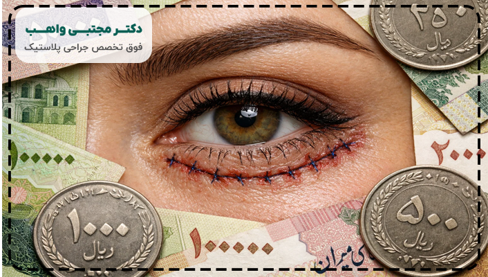 هزینه بلفاروپلاستی پلک پایین